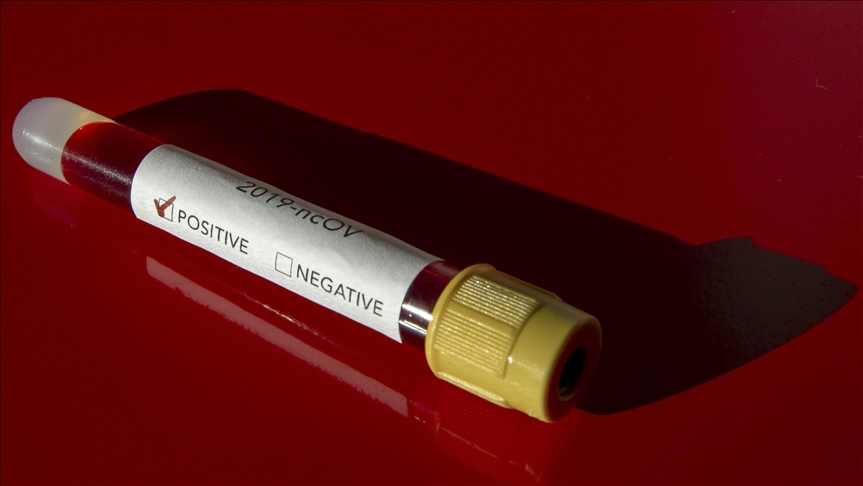 U Crnoj Gori 177 novih slučajeva zaraze koronavirusom, preminulo sedam osoba