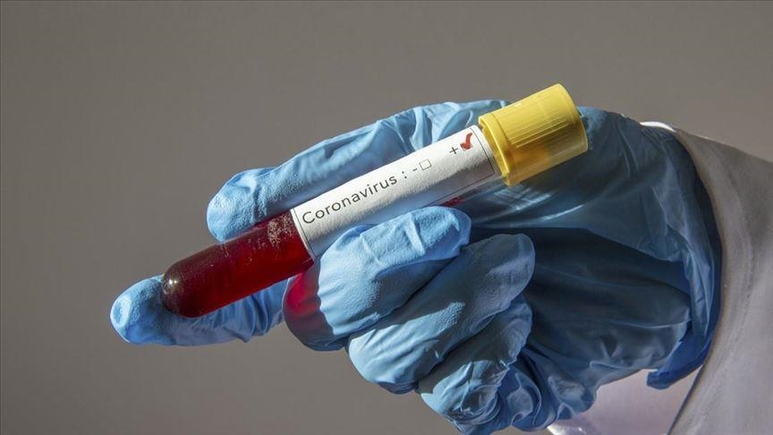 Crna Gora: Od COVID-19 preminulo još pet osoba, 112 novozaraženih