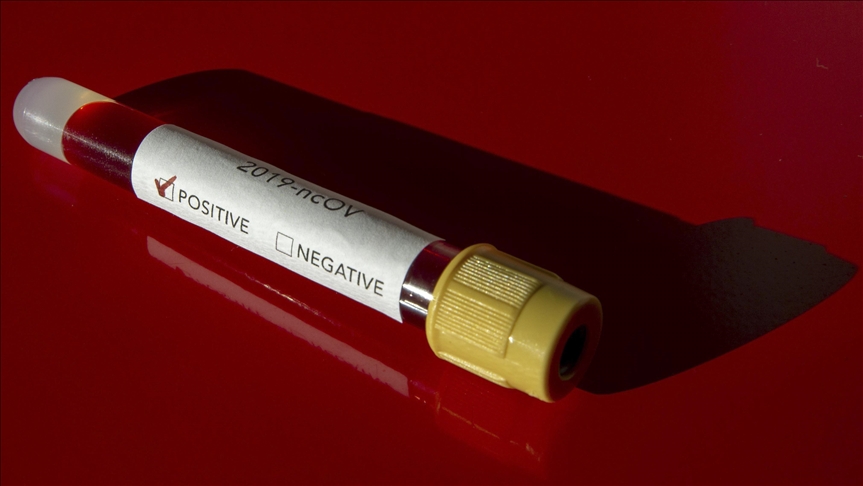 Hrvatska: Zabilježen 251 novozaraženi koronavirusom, preminulo još 20 osoba