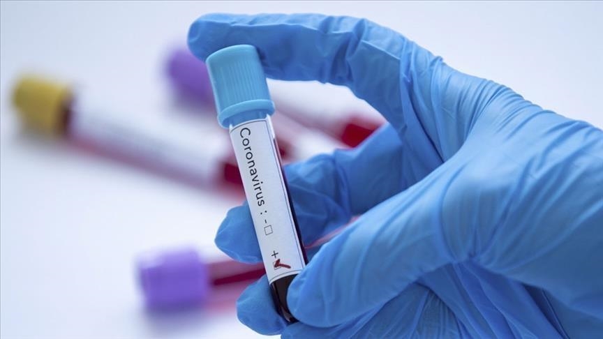 France/Covid-19 : pas de test PCR exigé pour les européens vaccinés