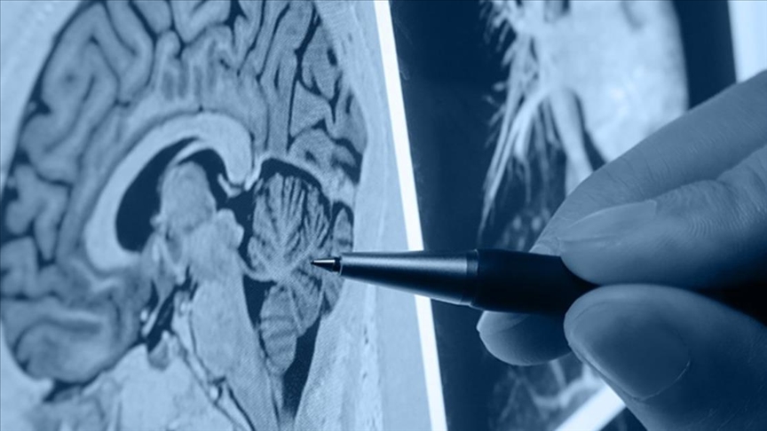 'Awareness campaigns give hope to amyotrophic lateral sclerosis patients'
