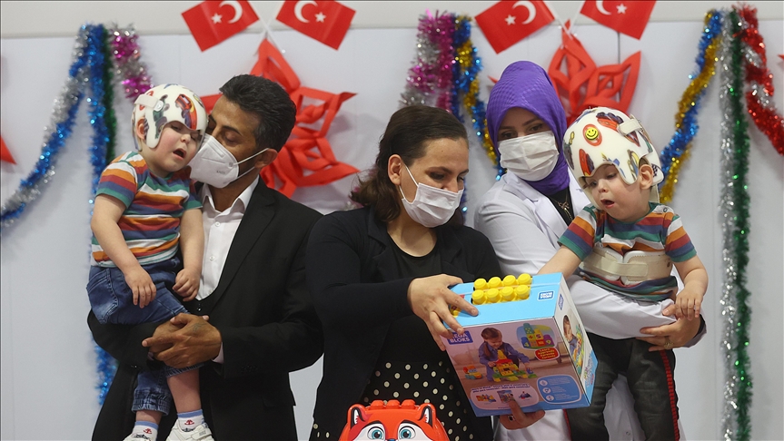 Turska: Sijamski blizanci razdvojeni operacijom slave treći rođendan