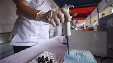 Kovid-19 teşhisini 10 saniyeye düşüren yerli test kullanıma sunuldu