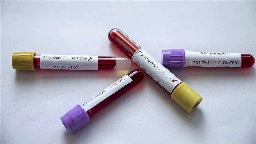 Na Kosovu pet pozitivnih slučajeva na koronavirus