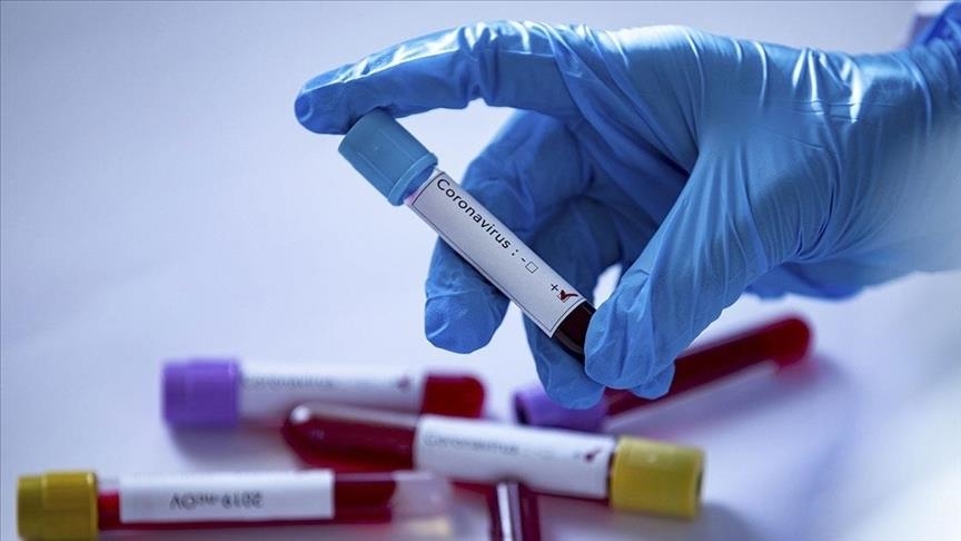 Sénégal : 30% des infections à la Covid-19 dus au variant Delta