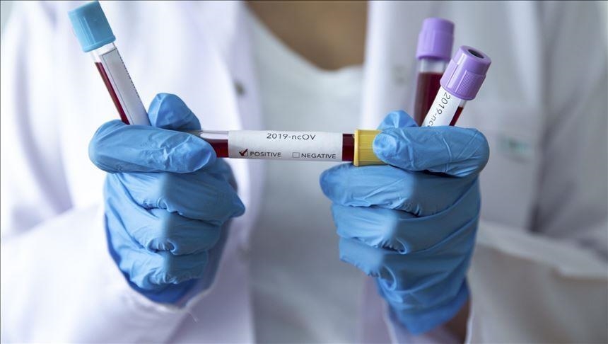 Srbija: Preminule još četiri osobe, 189 novozaraženih koronavirusom