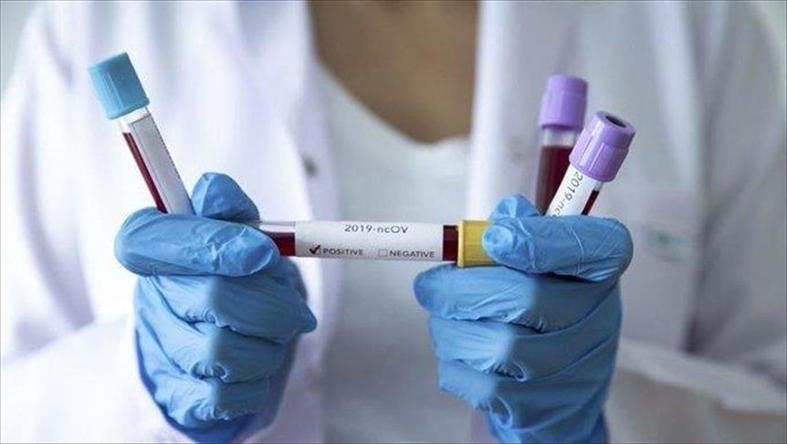 Nouvelle-Zélande / Covid-19 : Nouvelle recrudescence des contaminations
