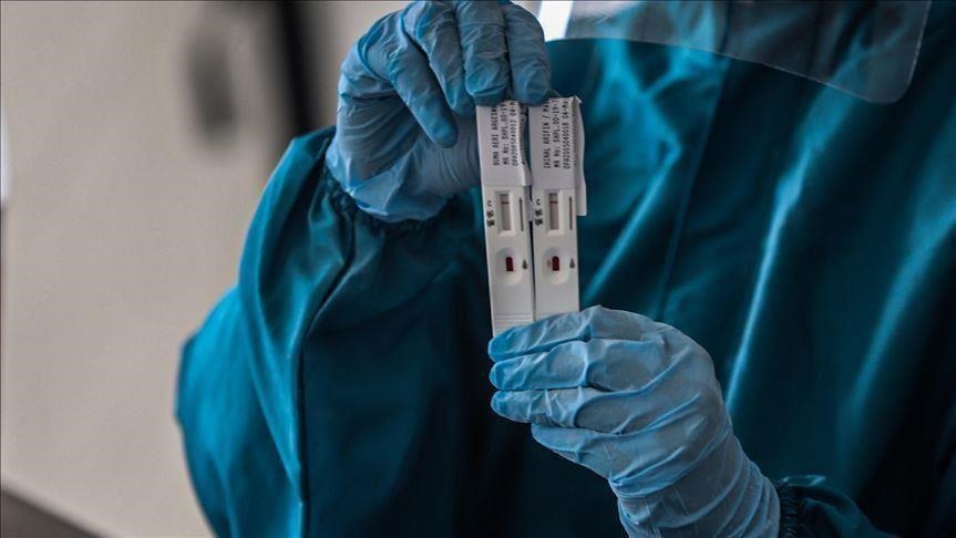 Crna Gora: Preminulo još pet osoba, 521 novi slučaj COVID-19