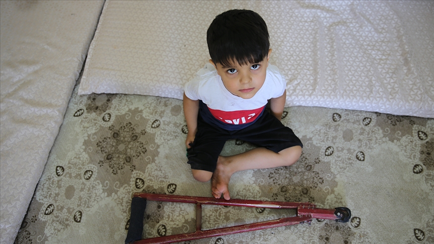 تركيا.. طفل سوري يثبّت قدمه بالحياة بواسطة ساقه الصناعية