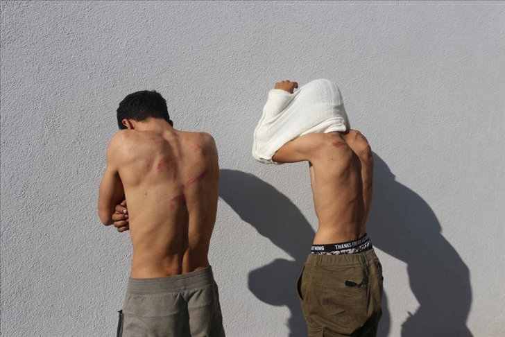 تركيا تعالج 13 طالب لجوء مغربي نكّلت اليونان بهم