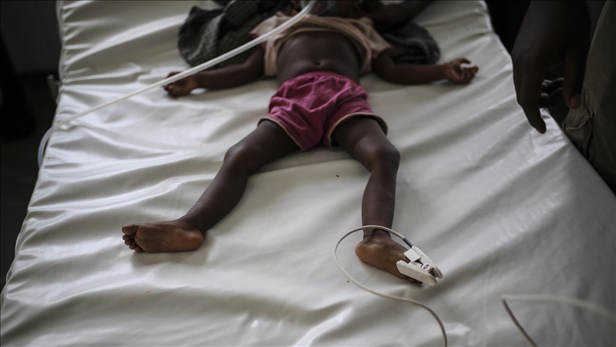 Authorities declare measles epidemic in DR Congos Maniema