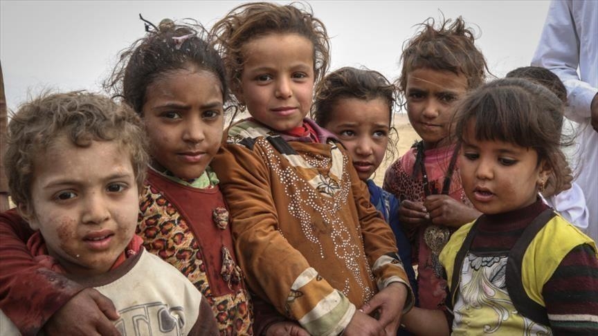75 بالمئة من أطفال اليمن يعانون من سوء التغذية المزمن