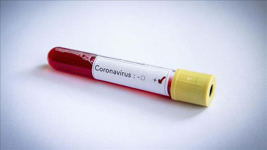 Na Kosovu 15 novozaraženih koronavirusom