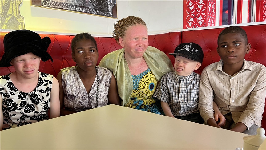 Kamerun’da albinoslar büyü ve batıl inançlar yüzünden tehdit altında