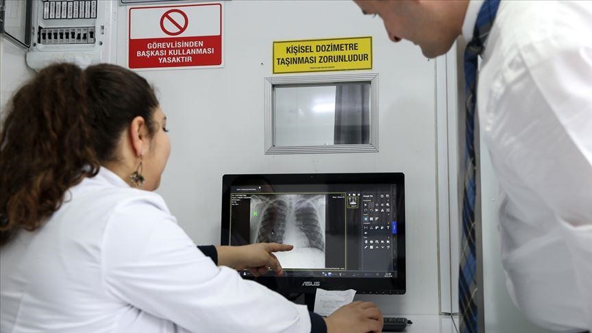 Turkiye remains below world, European average for tuberculosis-related deaths