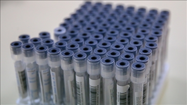 Bazı alanlarda PCR testi zorunluluğu kaldırıldı
