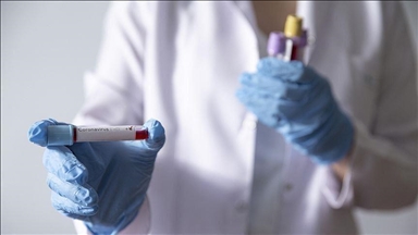 BiH: Registrovano 1.307 novozaraženih koronavirusom, preminulo još 15 osoba