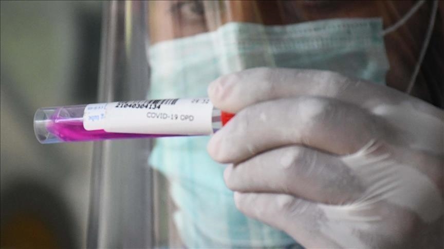 Hrvatska: Zabilježen 1.831 novi slučaj zaraze koronavirusom, preminule 44 osobe
