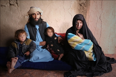 الفقر المدقع يدفع الأفغان لبيع أعضائهم 