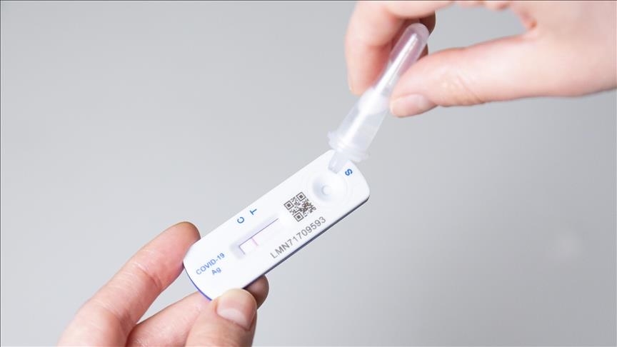 U BiH 2.073 novozaraženih koronavirusom, preminulo 65 osoba