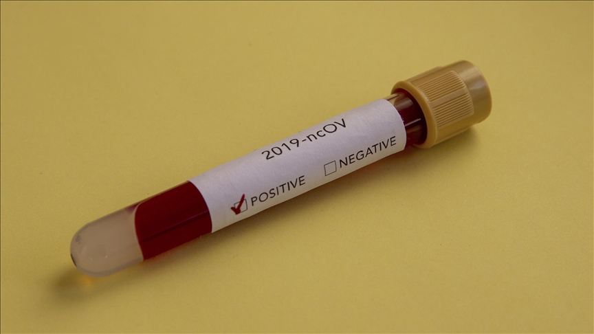 Srbija: Registrovano 13.153 novozaraženih koronavirusom, preminulo još 57 osoba