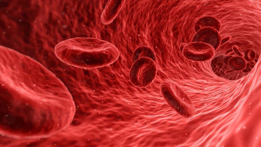 Turkish health care firm develops treatment for acute deep vein thrombosis
