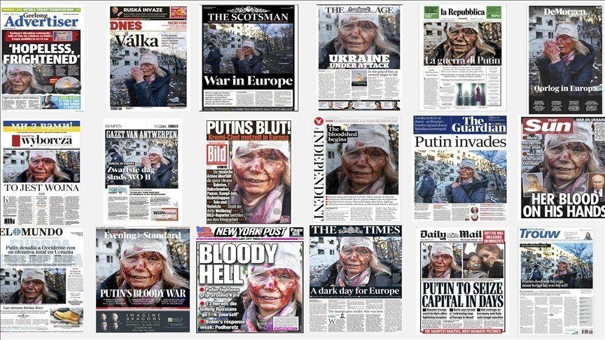 Imagen de la Agencia Anadolu de sobreviviente de un ataque aéreo en Ucrania expuso el rostro de la guerra al mundo