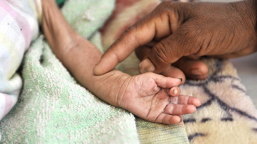 BiH: Udruženje ”Pomozi.ba” aktiviralo humanitarni broj 17043 za pomoć Jemenu