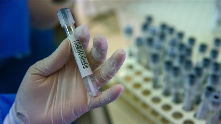 Hrvatska: Zabilježeno 406 novih slučajeva koronavirusa, sedam osoba preminulo