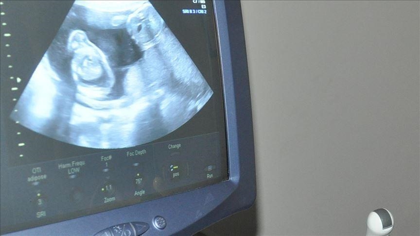 Rising c-sections in Cameroon cause for concern