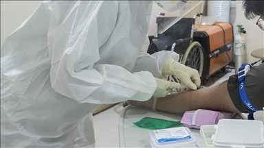 Zyrtarja e OBSH-së: Nuk ka nevojë për vaksinime masive kundër lisë së majmunit