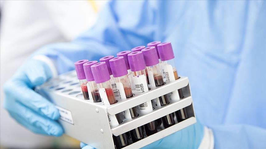 Hungary confirms 1st monkeypox case