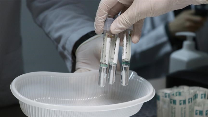 THY'den 'PCR test raporu' açıklaması
