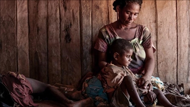 ЮНИСЕФ: каждую минуту в мире появляется еще один истощенный от голода ребенок 