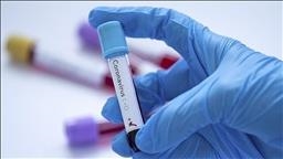 US researchers find possible universal monoclonal antibody coronavirus treatment US researchers find possible universal monoclonal antibody coronavirus treatment