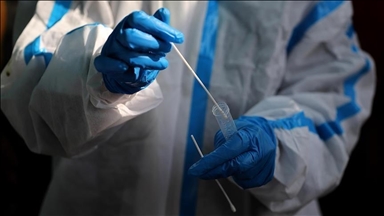 Hrvatska: Više od 1.500 novozaraženih koronavirusom, preminulo 15 osoba