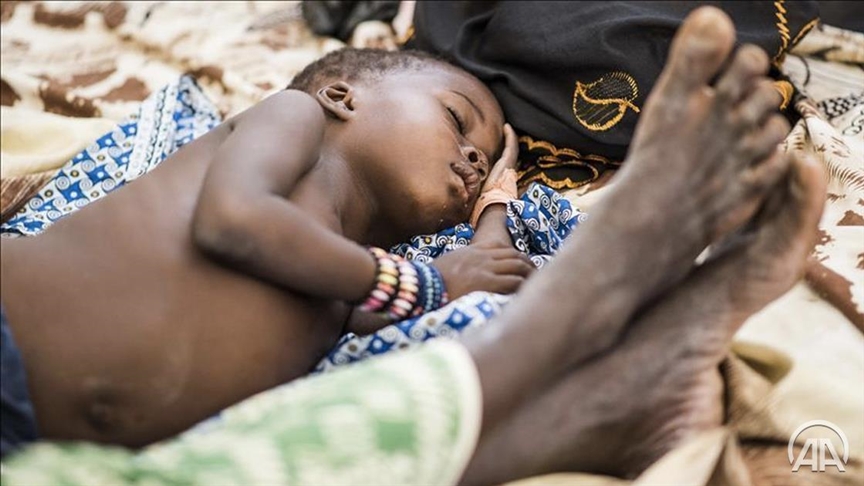 Nigeri, të paktën 190 fëmijë humbën jetën këtë vit nga epidemia e fruthit
