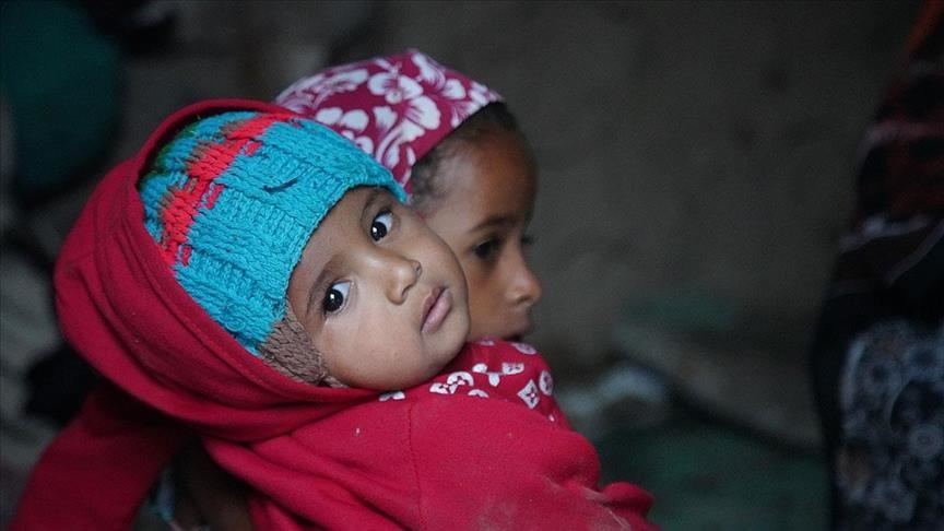 ЮНИСЕФ: В Йемене с начала года от кори умерло 15 детей 
