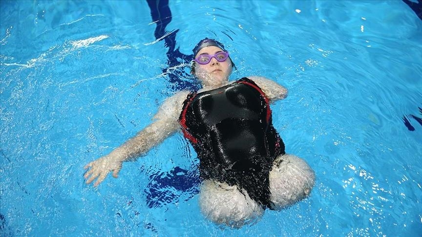Turkish swimmer with no legs, arm sets sights on national team