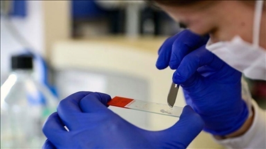 Chinese scientist claims COVID-19 may have originated from humans