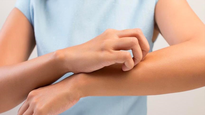 الحكة.. أنواعها وأسبابها و7 نصائح للتعامل معها (تقرير)