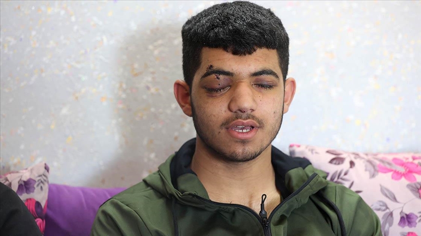 İsrail'in attığı ses bombası nedeniyle görme yetisini kaybeden Filistinli çocuk "hayallerine" tutunuyor