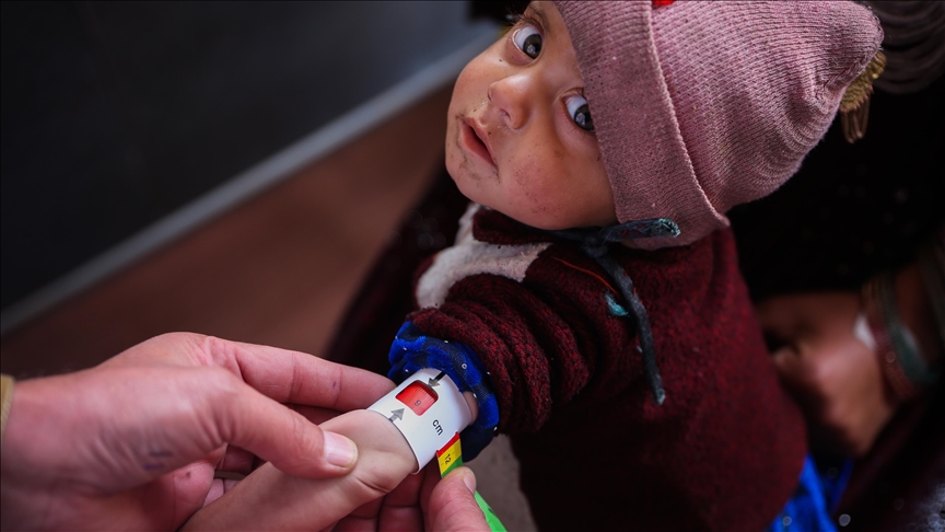 Hunger set to worsen in 18 'hotspots' worldwide: Report