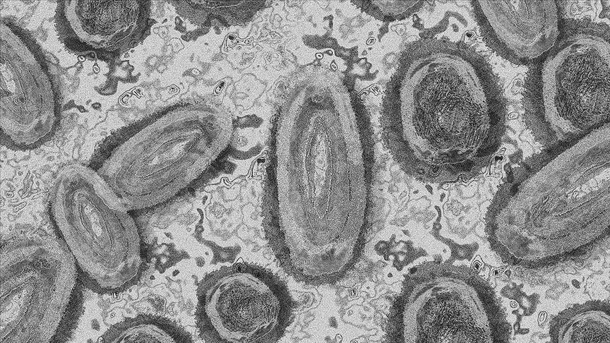 China reports monkeypox case