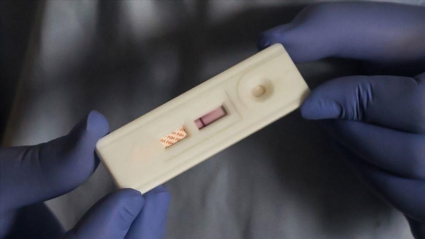 AIDS can be ended by 2030 with political will, investment: UNAIDS 