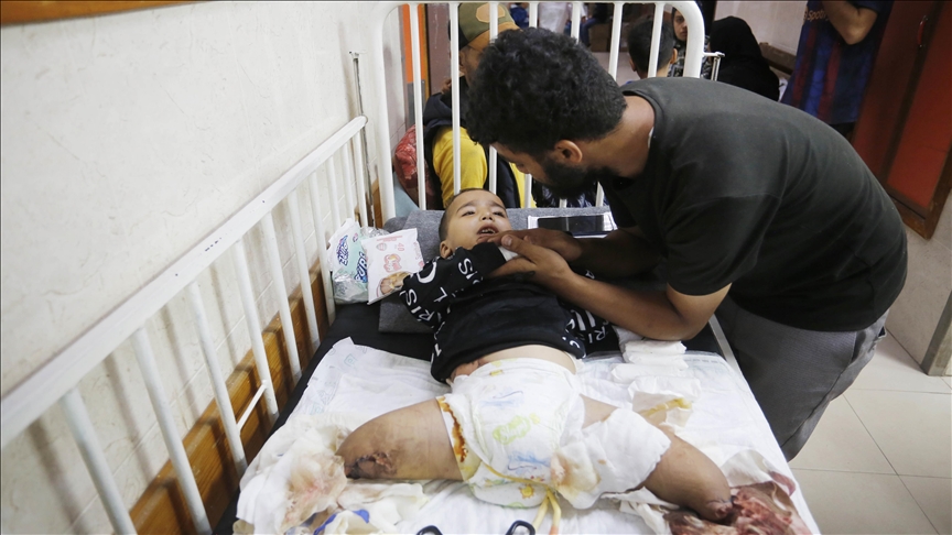 Тригодишниот Ахмед од Газа преживеа три израелски напади: Ампутирани му се двете нозе
