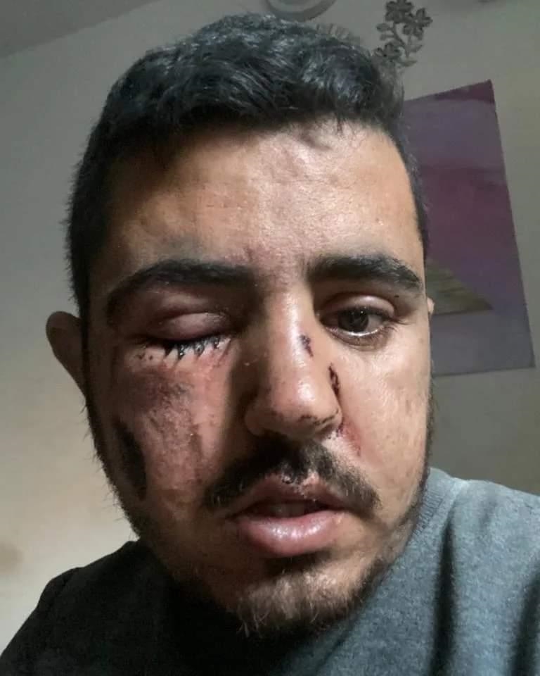 Fotógrafo de la Agencia Anadolu pierde a 47 miembros de su familia en un ataque aéreo de Israel