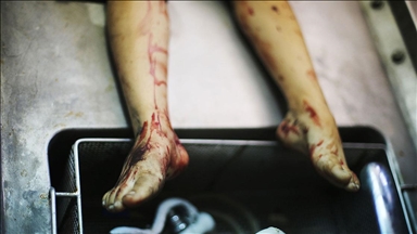 İsrail'in Gazze'de zorla boşalttığı hastanede kalan bebeklerin çürümüş cesetleri bulundu