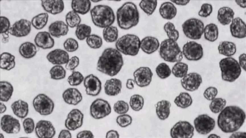 ‘Anthrobots’: Turkish scientist in US leads study creating biological robots from human cells