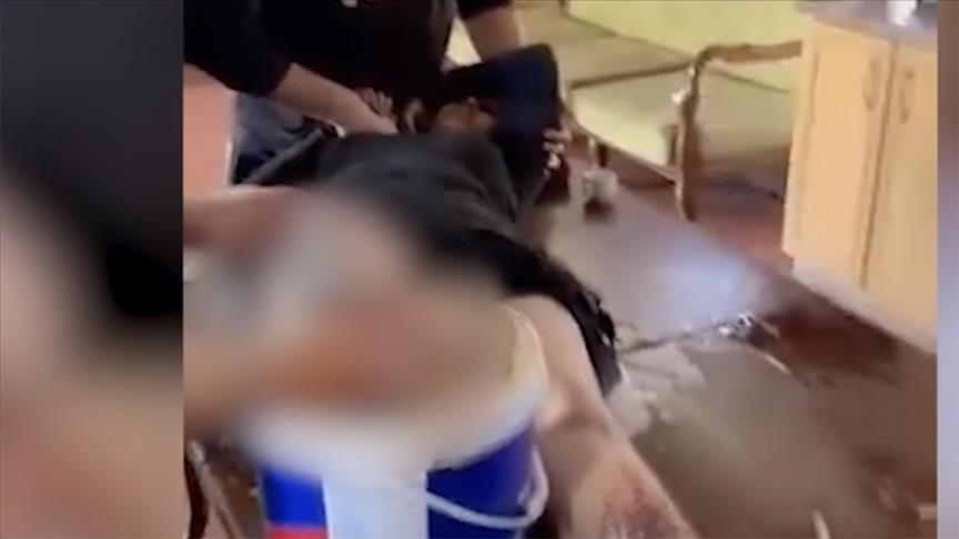 Dokter Gaza amputasi kaki keponakannya di meja dapur tanpa anestesi